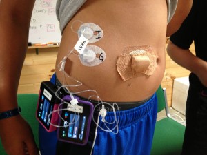 Bionic Pancreas Camp Study Pictures