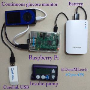 what-an-openaps-looks-like-by-danamlewis1-300x300
