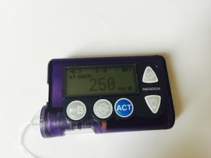 insulin pump5