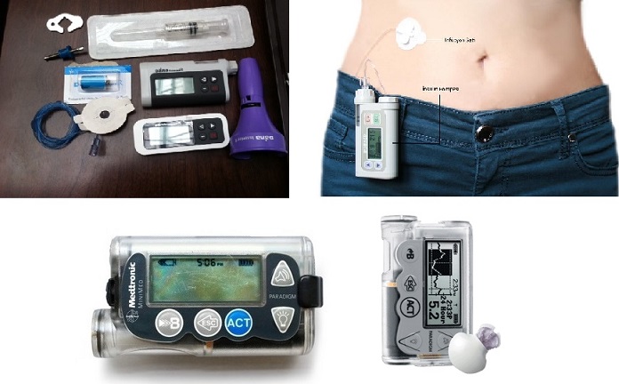 Sensörlü insülin pompası fiyatları
